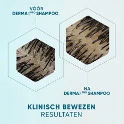 DermaXPro by Head & Shoulders Revitaliseert Antiroosshampoo