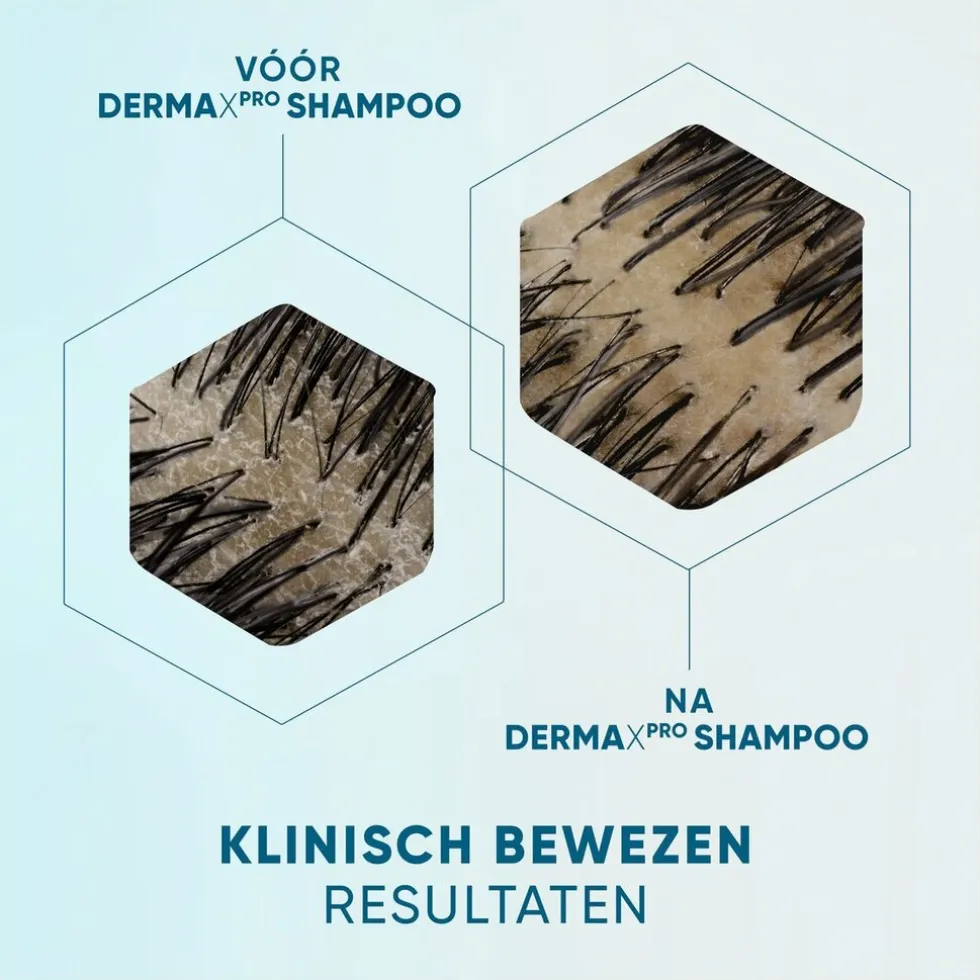 DermaXPro by Head & Shoulders Kalmeert Antiroosshampoo