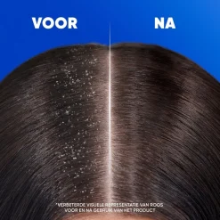 Head & Shoulders Menthol Fresh Antiroosshampoo
