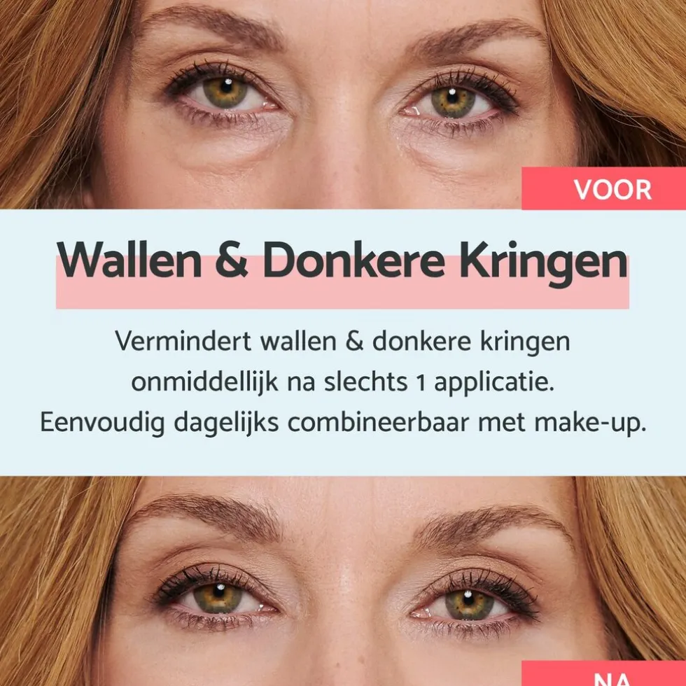 Remescar Wallen & Donkere Kringen Crème