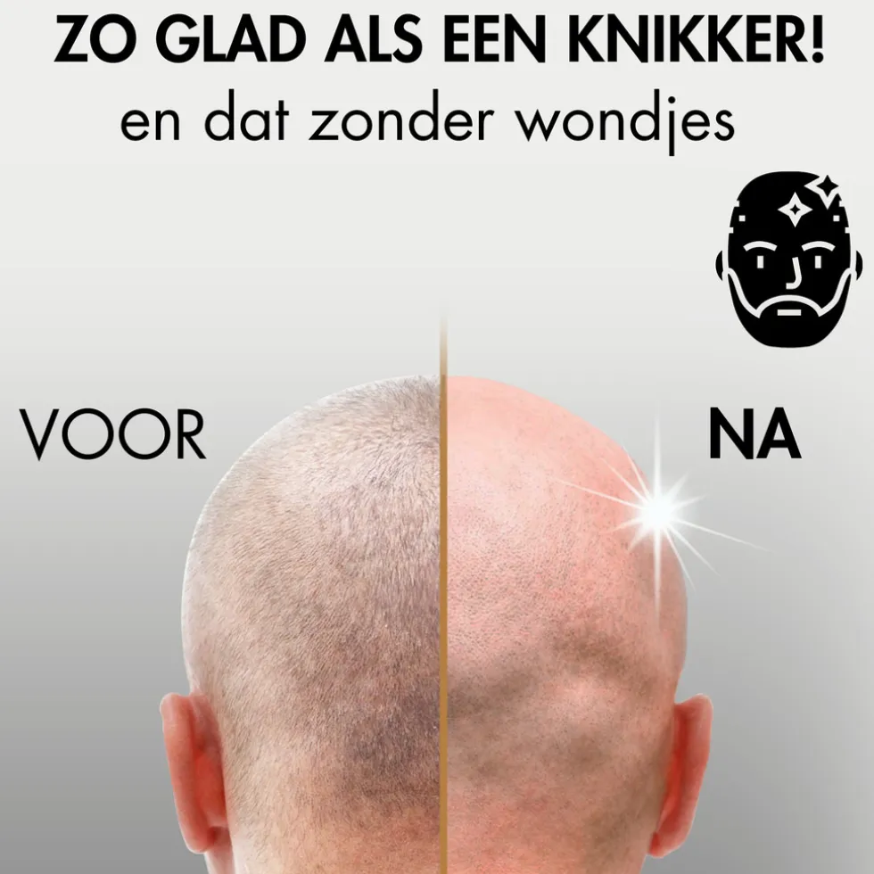 Sansbeauté Hoofdscheerapparaat + Extra Scheerkop - Skull Shaver - Pro Magnetic
