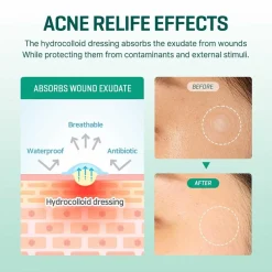 SOME BY MI Clear Spot Patch