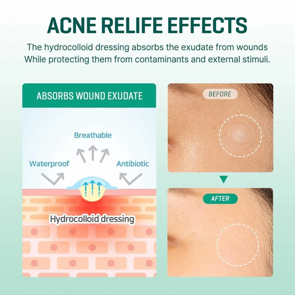 SOME BY MI Clear Spot Patch