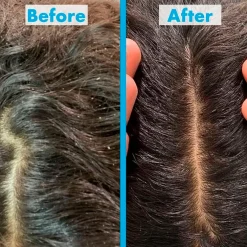 Umberto Giannini Scalp Restore Shampoo